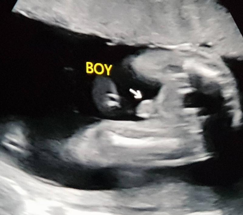 เบนซ์ พริกไทย เบนซ์ พริกไทย