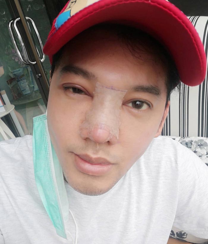 ดีเจเจ๊แหม่ม ศัลยกรรม ดีเจเจ๊แหม่ม ศัลยกรรม