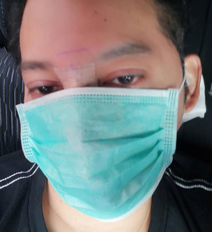 ดีเจเจ๊แหม่ม ศัลยกรรม ดีเจเจ๊แหม่ม ศัลยกรรม