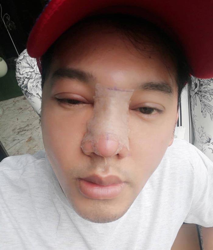 ดีเจเจ๊แหม่ม ศัลยกรรม ดีเจเจ๊แหม่ม ศัลยกรรม