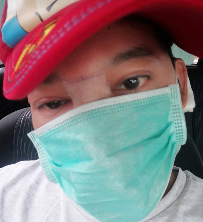 ดีเจเจ๊แหม่ม ศัลยกรรม ดีเจเจ๊แหม่ม ศัลยกรรม