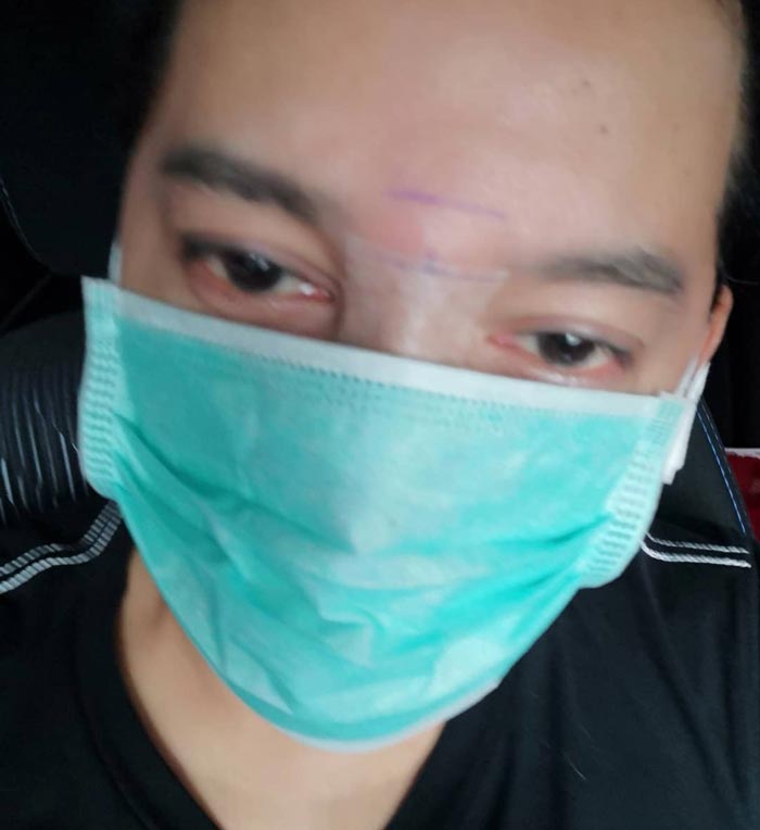 ดีเจเจ๊แหม่ม ศัลยกรรม ดีเจเจ๊แหม่ม ศัลยกรรม