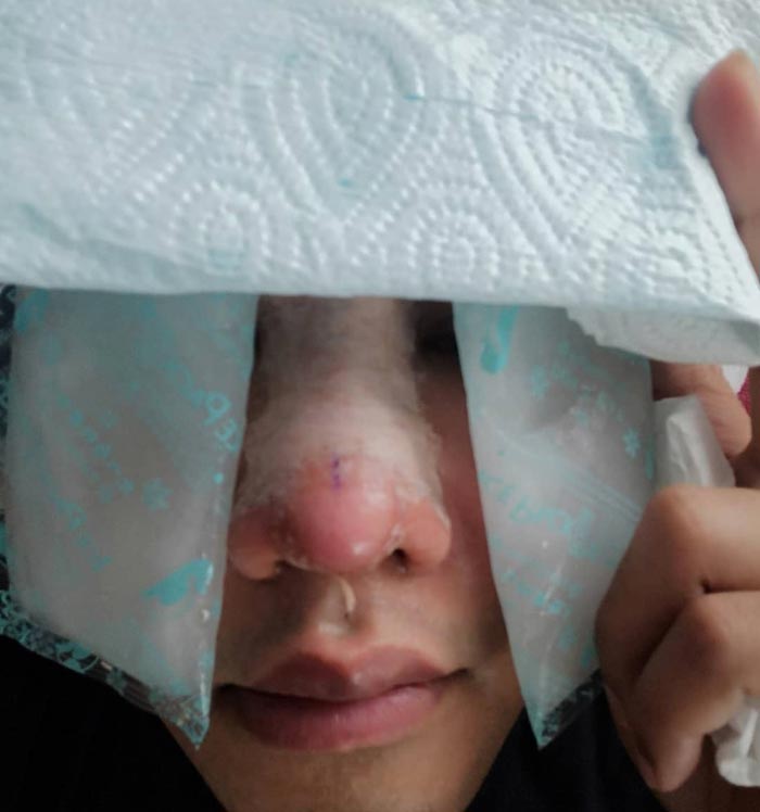 ดีเจเจ๊แหม่ม ศัลยกรรม ดีเจเจ๊แหม่ม ศัลยกรรม