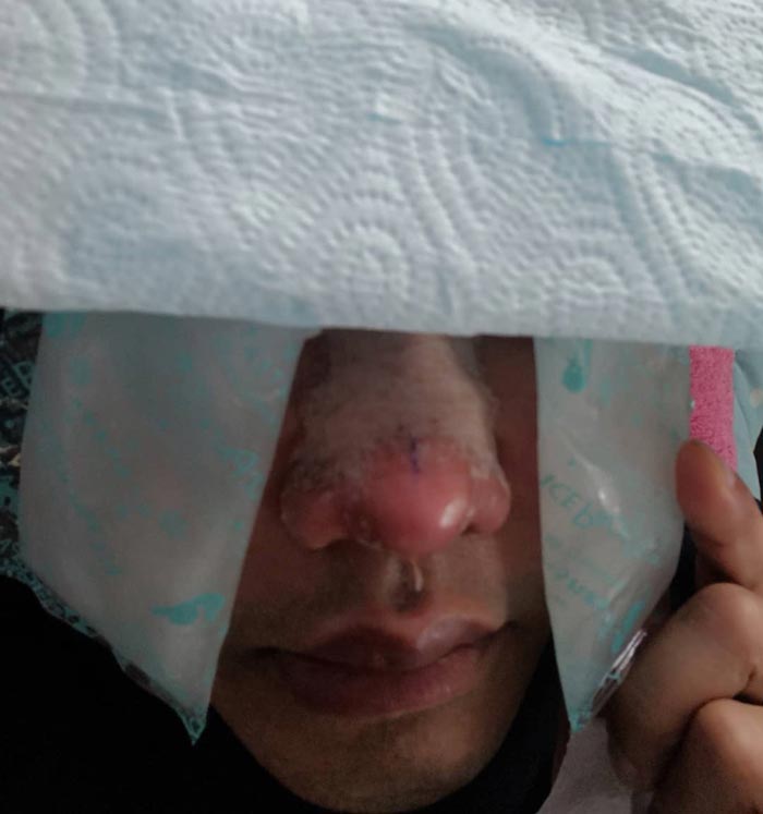 ดีเจเจ๊แหม่ม ศัลยกรรม ดีเจเจ๊แหม่ม ศัลยกรรม