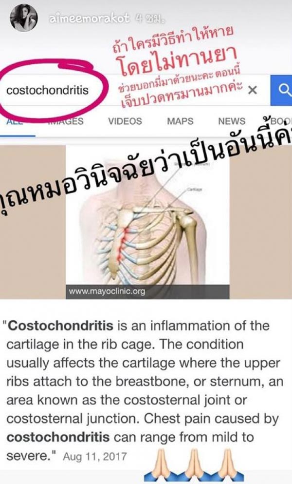 เอมมี่ ไฮโซเจมส์ เอมมี่ ไฮโซเจมส์
