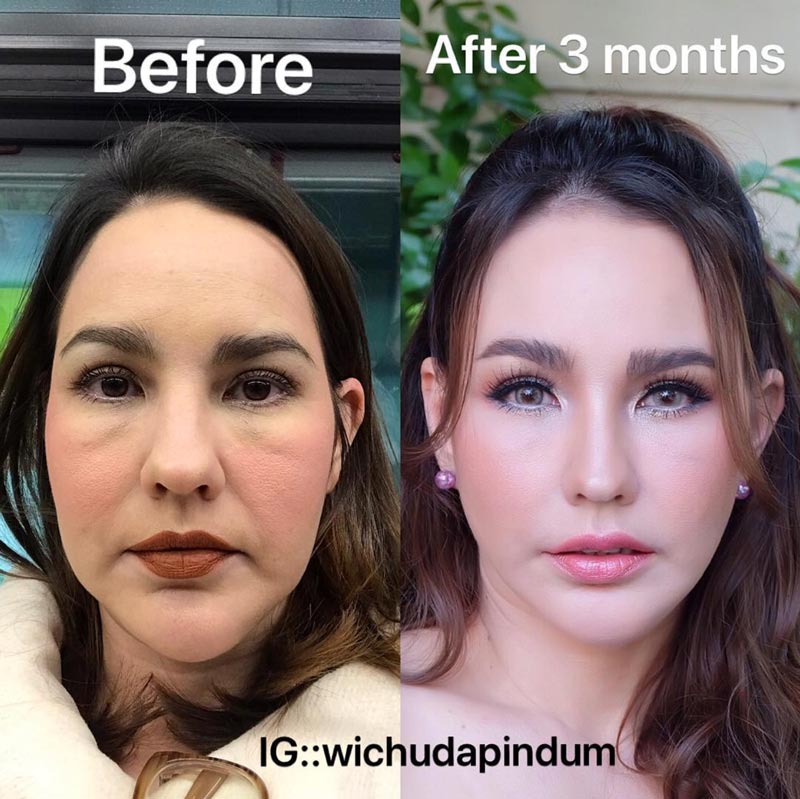 แหม่ม วิชุดา แหม่ม วิชุดา