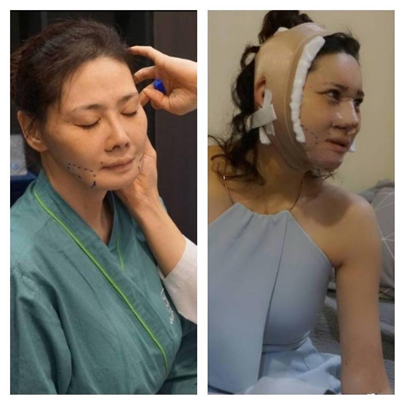 โยโกะ ทาคาโน่ โยโกะ ทาคาโน่