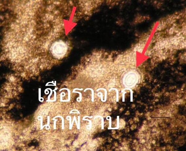 ติดเชื้อสปอร์เห็ด ติดเชื้อสปอร์เห็ด