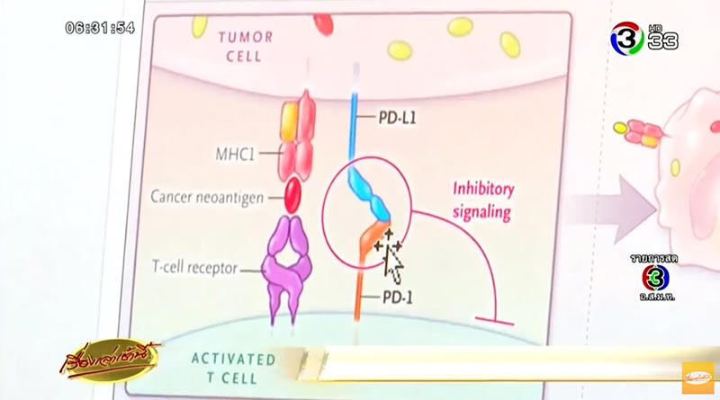 แอนตี้บอดี้รักษามะเร็ง แอนตี้บอดี้รักษามะเร็ง