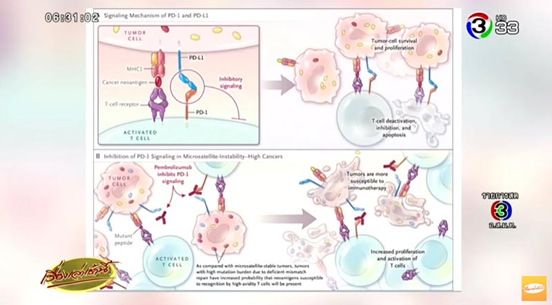 แอนตี้บอดี้รักษามะเร็ง แอนตี้บอดี้รักษามะเร็ง
