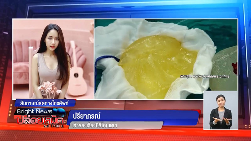 เสริมนม เสริมนม