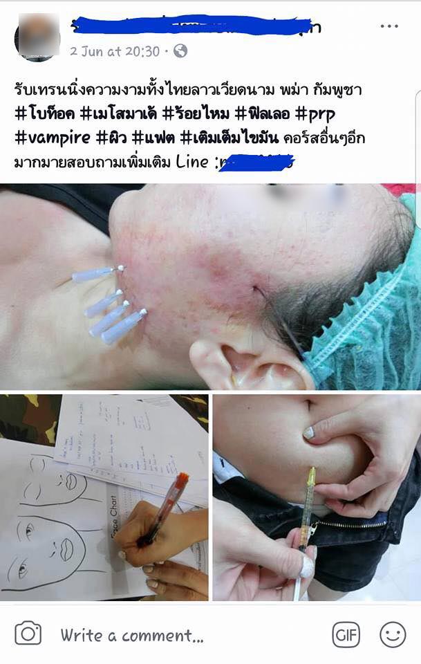 สอนร้อยไหม สอนร้อยไหม