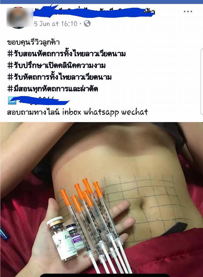 สอนร้อยไหม สอนร้อยไหม