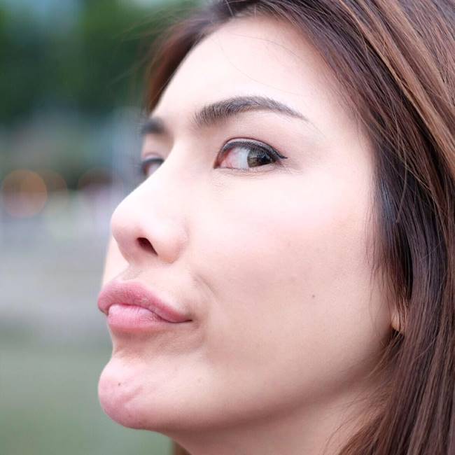 ป้อม วินิจ แก้ม กวินตรา ป้อม วินิจ แก้ม กวินตรา