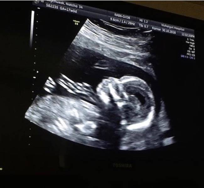 เจมส์ เรืองศักดิ์ เจมส์ เรืองศักดิ์