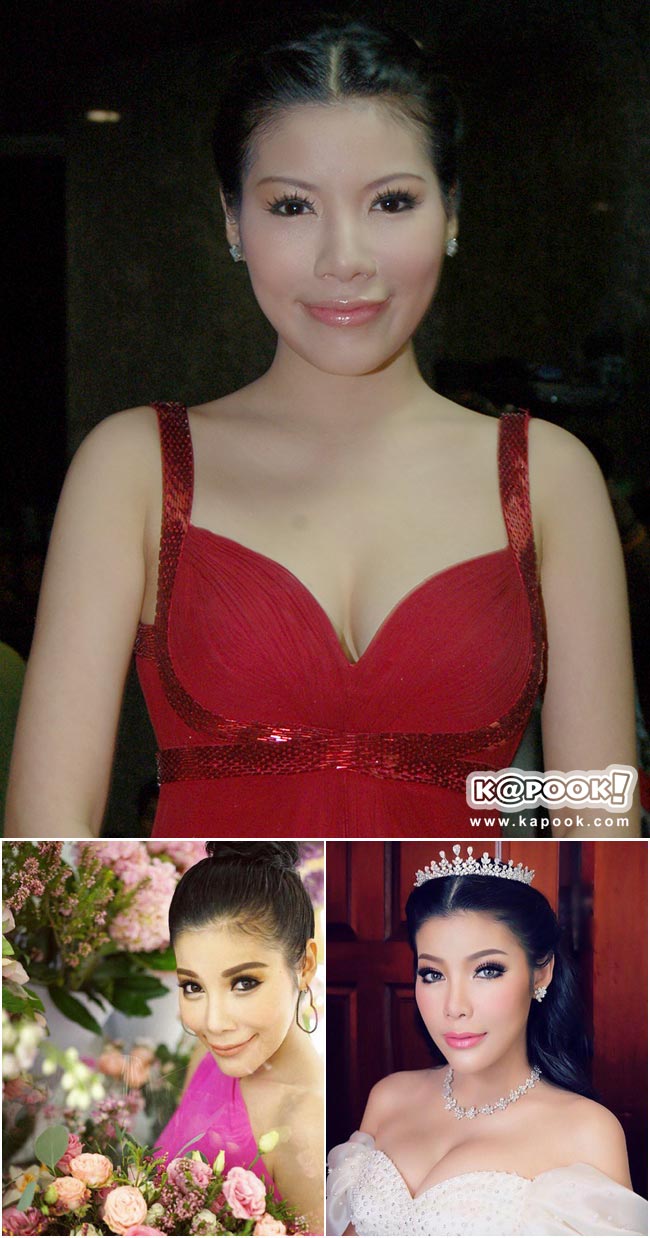 ดาราศัลยกรรมเกาหลี ดาราศัลยกรรมเกาหลี