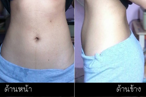 ลดน้ำหนัก ลดน้ำหนัก