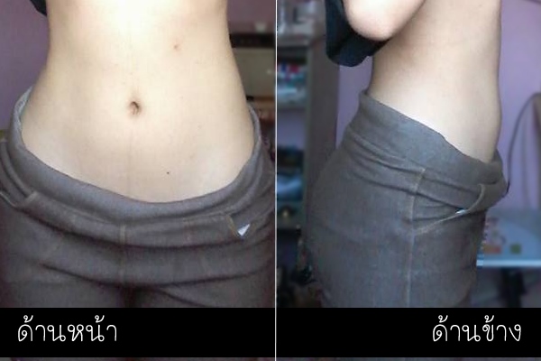 ลดน้ำหนัก ลดน้ำหนัก
