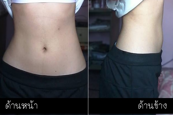 ลดน้ำหนัก ลดน้ำหนัก