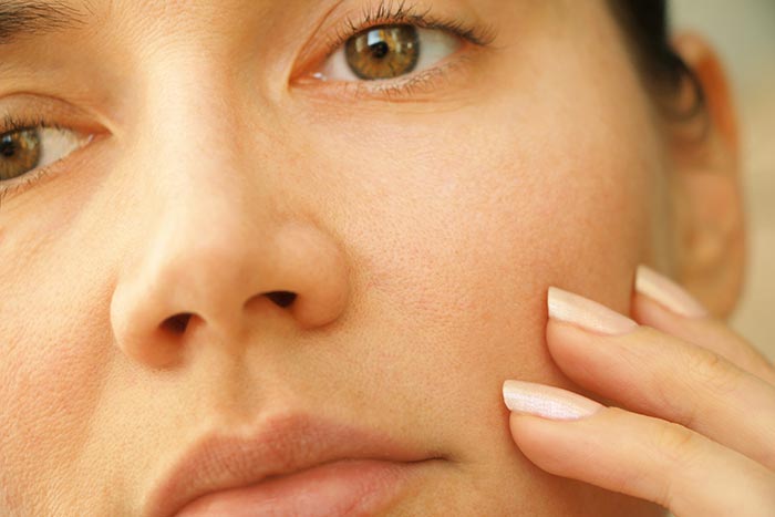 รูขุมขนกว้าง รูขุมขนกว้าง