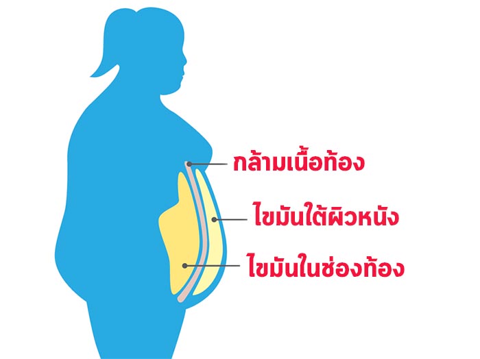 ไขมันในช่องท้อง ไขมันในช่องท้อง