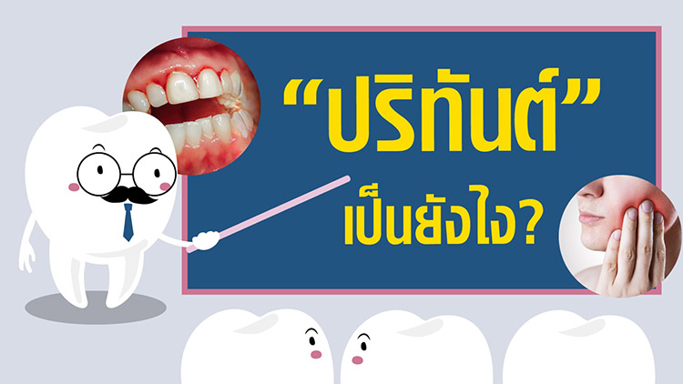 ปริทันต์ ปริทันต์