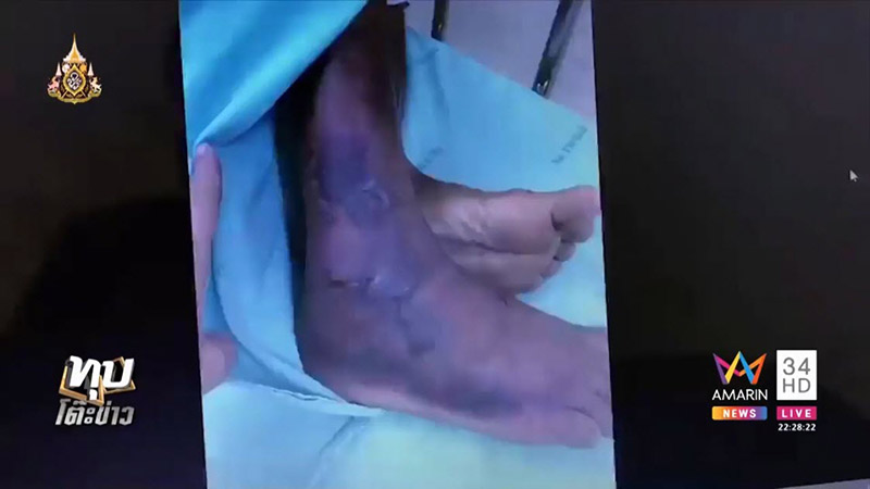 ร้องเรียนโรงพยาบาล ร้องเรียนโรงพยาบาล