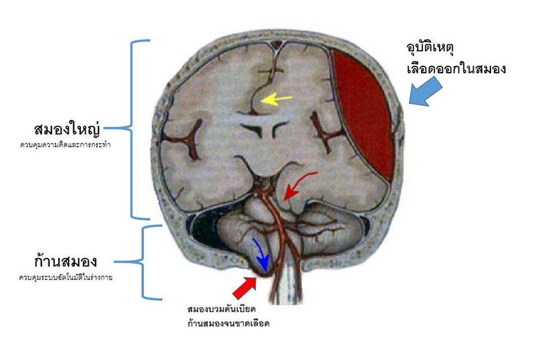 โรคทางสมอง โรคทางสมอง