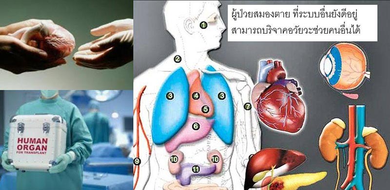 โรคทางสมอง โรคทางสมอง
