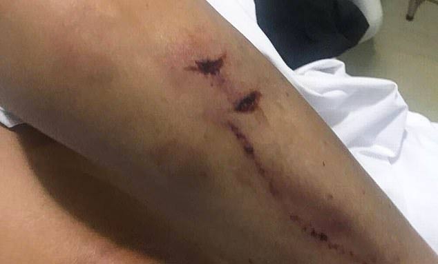 ทำร้ายร่างกาย ทำร้ายร่างกาย