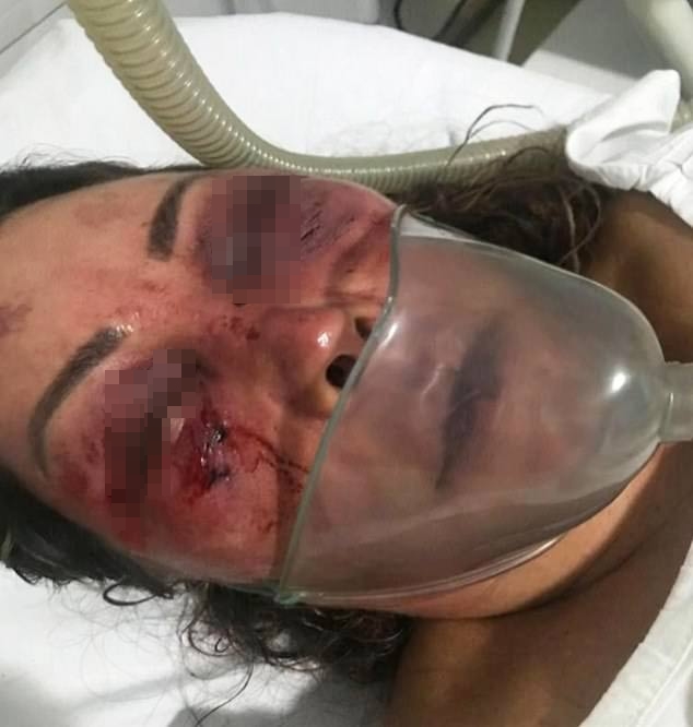 ทำร้ายร่างกาย ทำร้ายร่างกาย