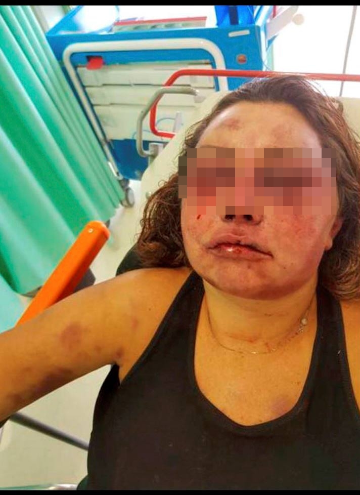 ทำร้ายร่างกาย ทำร้ายร่างกาย