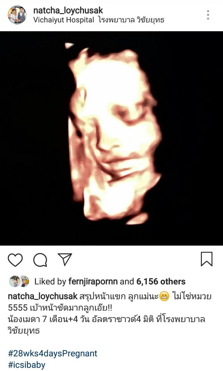 น้องอันโดรเมดาลูกเจมส์ ครูก้อย น้องอันโดรเมดาลูกเจมส์ ครูก้อย