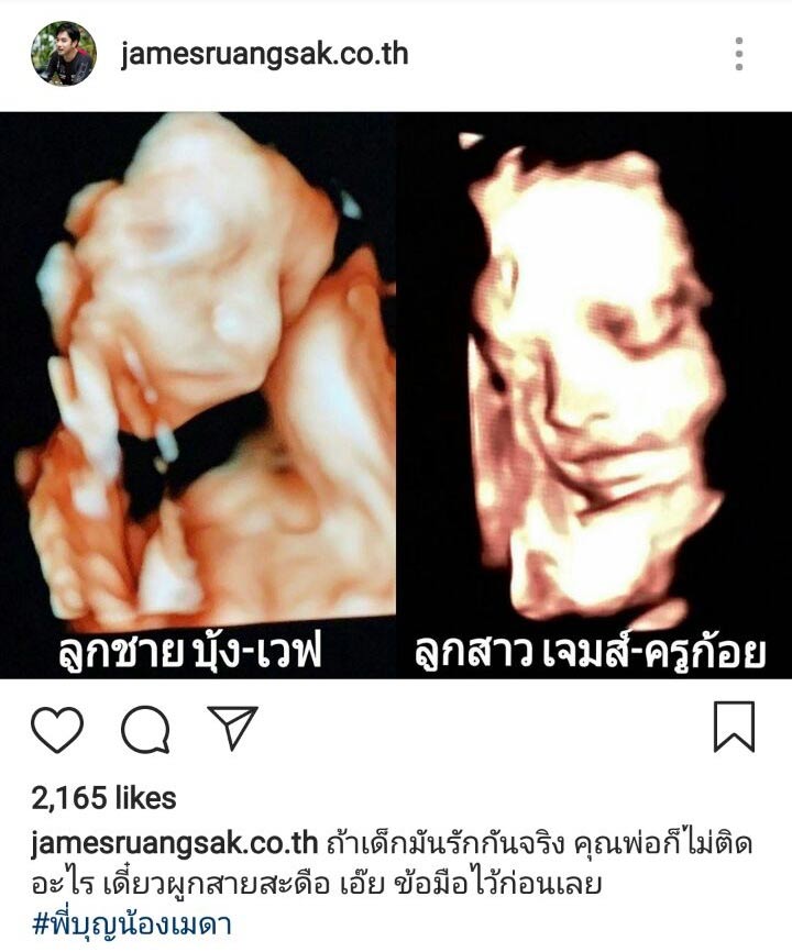 เจมส์ เรืองศักดิ์ เจมส์ เรืองศักดิ์