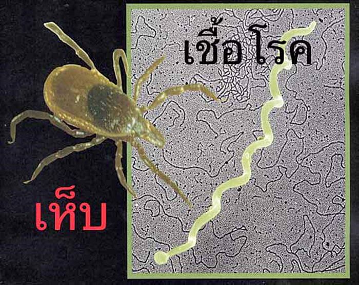 โรคลายม์ Lyme  โรคลายม์ Lyme