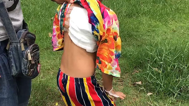 หมากัดคน หมากัดคน