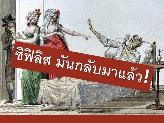 โรคซิฟิลิส โรคซิฟิลิส