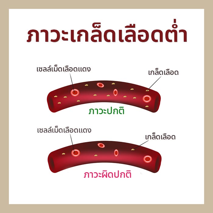 เกล็ดเลือดต่ำ เกล็ดเลือดต่ำ