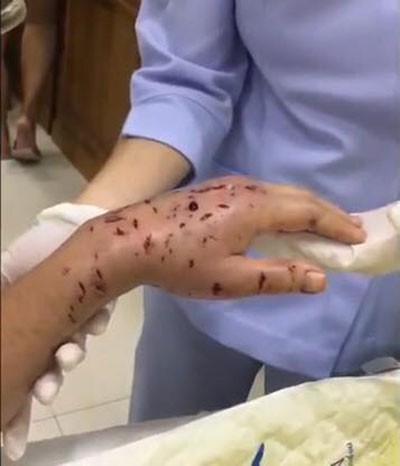 หมาบางแก้ว หมาบางแก้ว