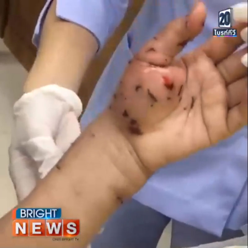 หมาบางแก้ว หมาบางแก้ว