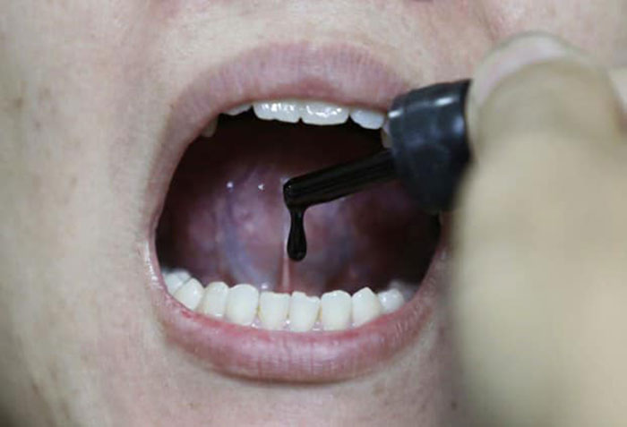 น้ำมันกัญชา น้ำมันกัญชา