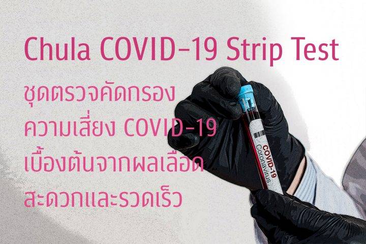 ชุดตรวจโควิด ชุดตรวจโควิด