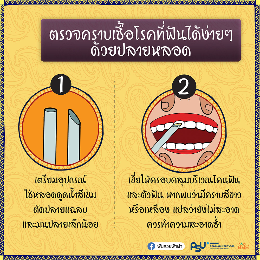 ฟันผุ ฟันผุ