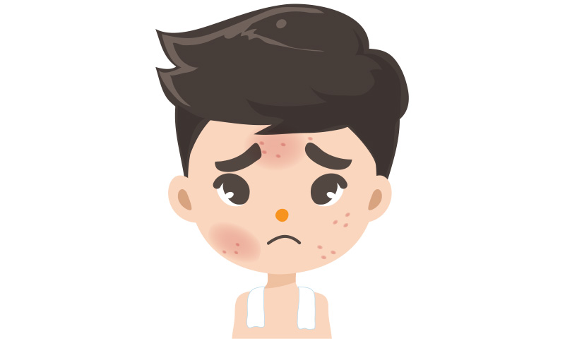 วิธีดูแลผิว วิธีดูแลผิว
