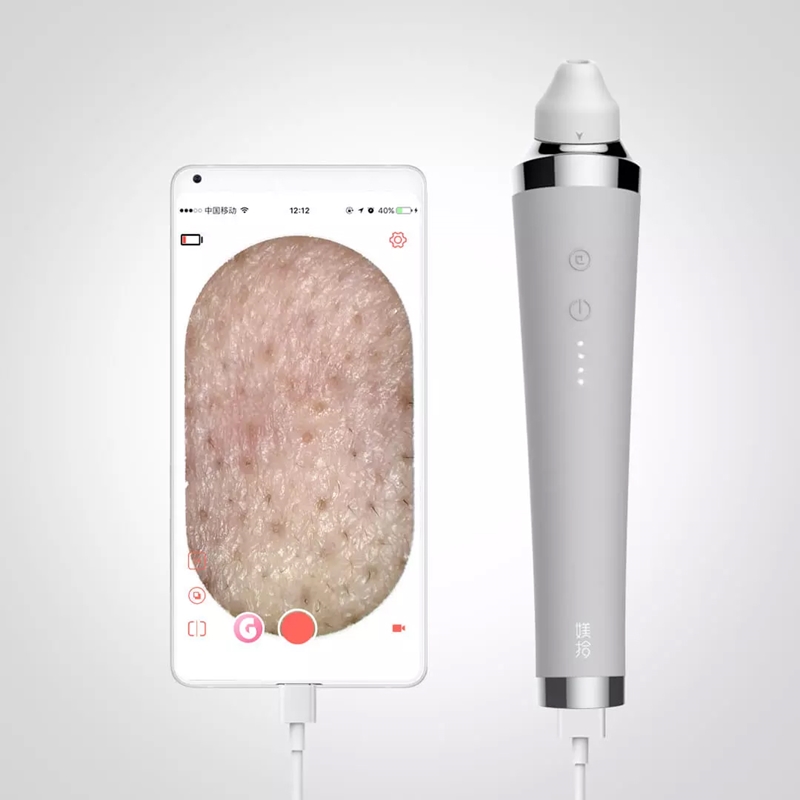 เครื่องดูดสิว xiaomi เครื่องดูดสิว xiaomi