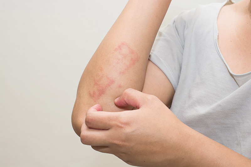 ครีมทาผิวขาว ครีมทาผิวขาว