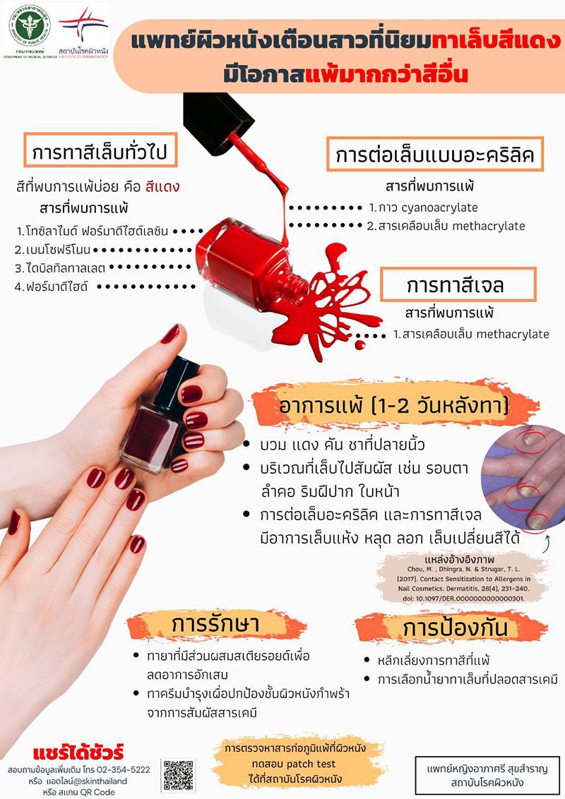 ทาเล็บสีแดงเสี่ยงแพ้ ทาเล็บสีแดงเสี่ยงแพ้