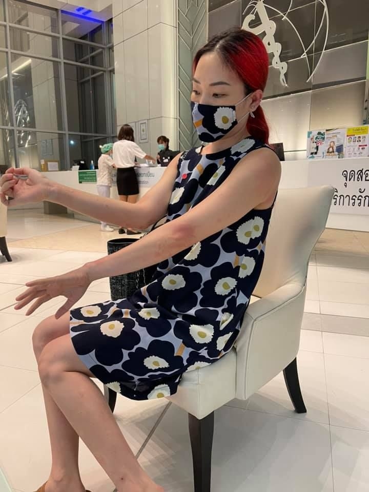 แพ้วัคซีนซิโนแวค แพ้วัคซีนซิโนแวค