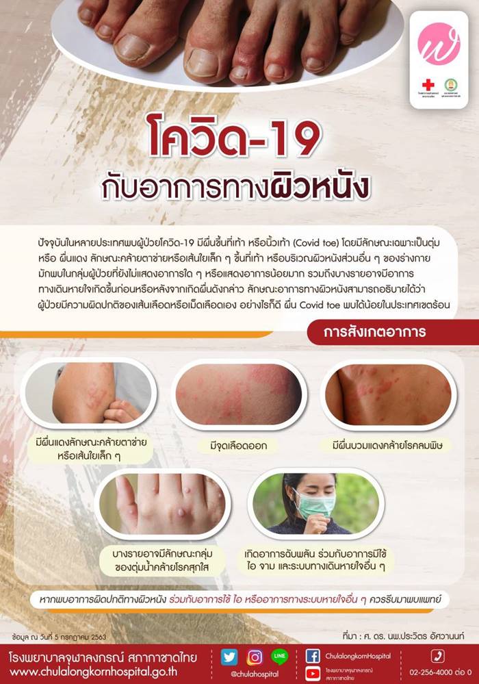 อาการโควิด 19 อาการโควิด 19