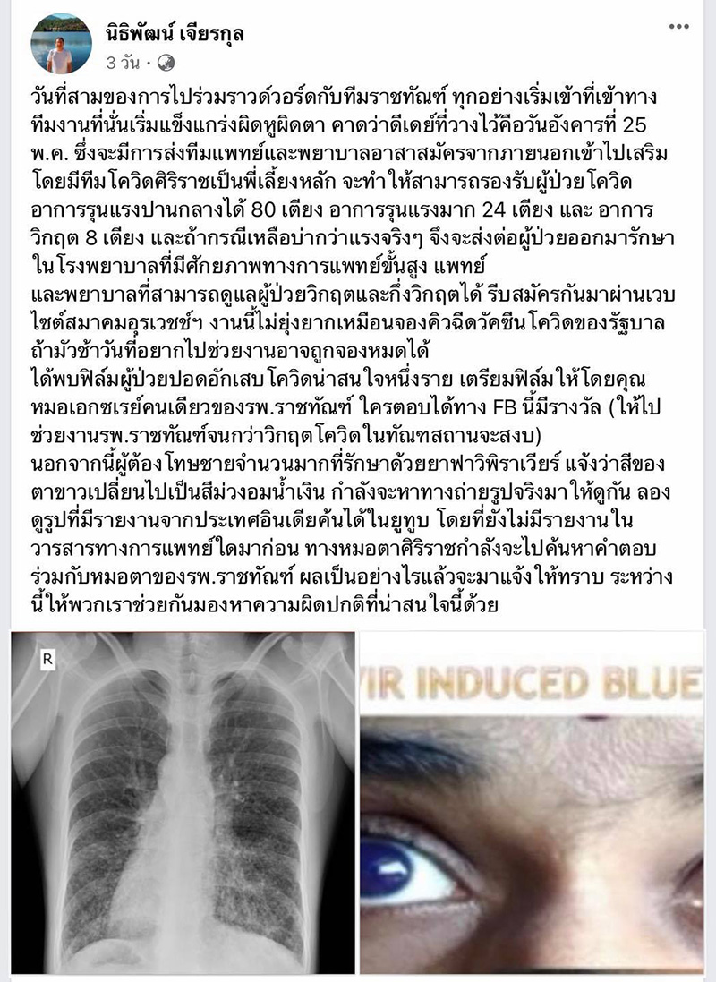 เปิดข้อมูลแปลก ! คนไข้โควิด 19 ตาเรืองแสง เปิดข้อมูลแปลก ! คนไข้โควิด 19 ตาเรืองแสง